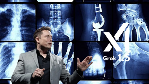 Elon Musk Promotes AI Health Revolution with Grok Medical Scans